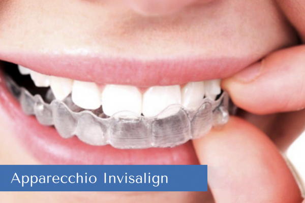 ortodonzia invisibil